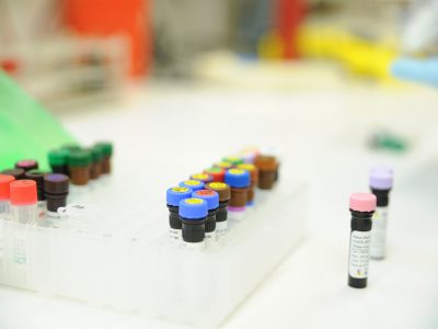 Immunothérapies, nouvelles classes thrérapeutiques : les axes de recherche en cours à l’IPC
